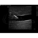 Modelo de línea central de ultrasonido Gen II transparente - Imagen 5