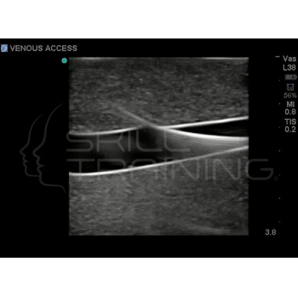 Modelo de línea central de ultrasonido Gen II transparente - Imagen 7