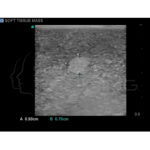 Modelo de entrenamiento de ultrasonido de biopsia de mama - Imagen 2