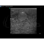 Modelo de entrenamiento de ultrasonido de biopsia de mama - Imagen 5