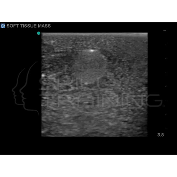 Modelo de entrenamiento de ultrasonido de biopsia de mama - Imagen 5