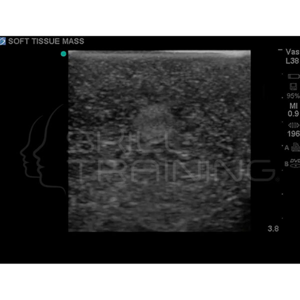 Modelo de entrenamiento de ultrasonido de biopsia de mama - Imagen 6