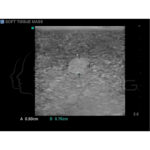 Modelo de entrenamiento de ultrasonido de biopsia de mama - Imagen 7