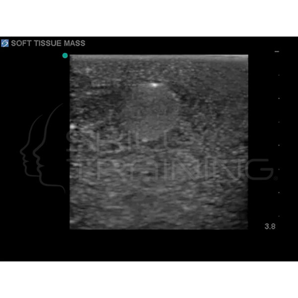 Modelo de entrenamiento de ultrasonido de biopsia de mama - Imagen 8