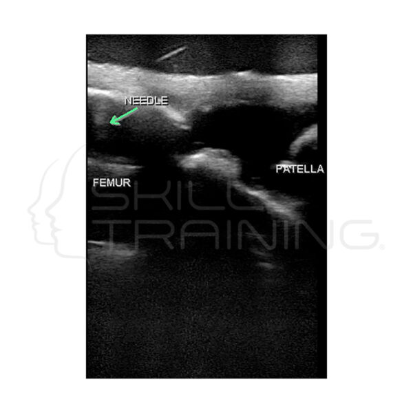 Ultrasonido musculoesquelético (MSK) Blue Phantom - Imagen 6