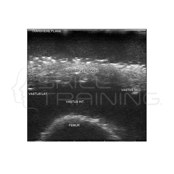 Ultrasonido musculoesquelético (MSK) Blue Phantom - Imagen 7