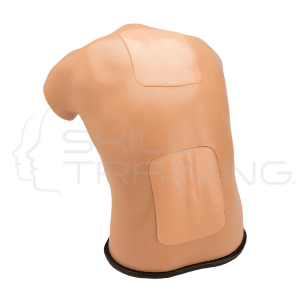 Punción lumbar y epidural espinal - Imagen 1