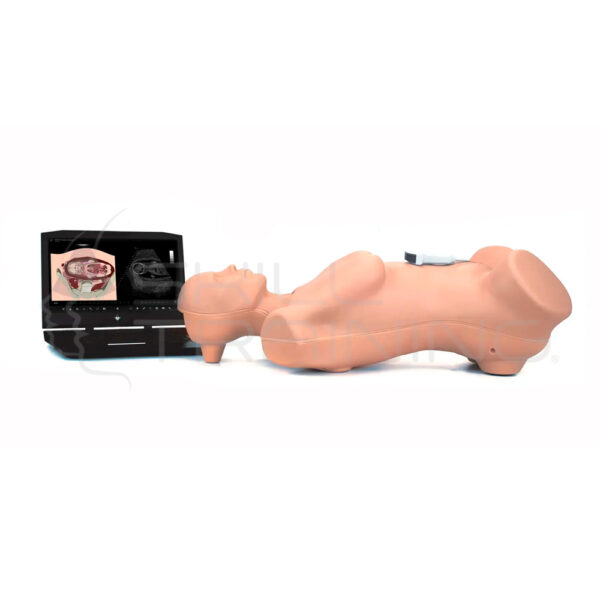 Elevate Healthcare Vimedix - Simulador de Ultrasonido Ob/gyn Curvilíneo - Unidad - Imagen 1