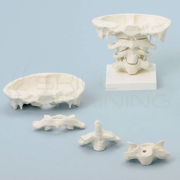 Articulaciones de cabeza - Imagen 1