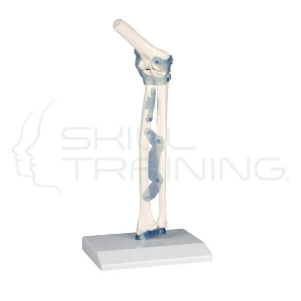 Articulación del codo con ligamentos con soporte - Imagen 1