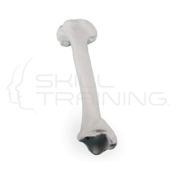 Tibia izquierda - Imagen 1