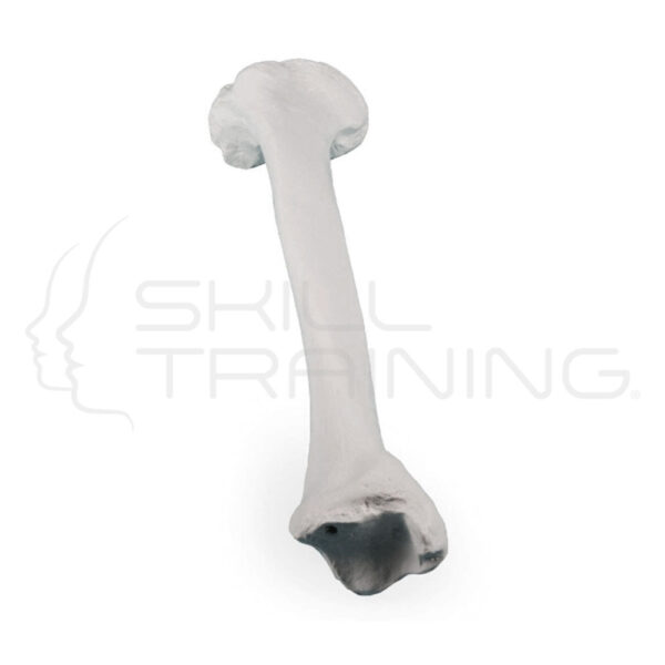 Tibia derecha - Imagen 1
