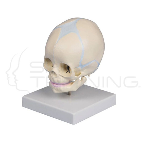 Cráneo fetal - Imagen 1