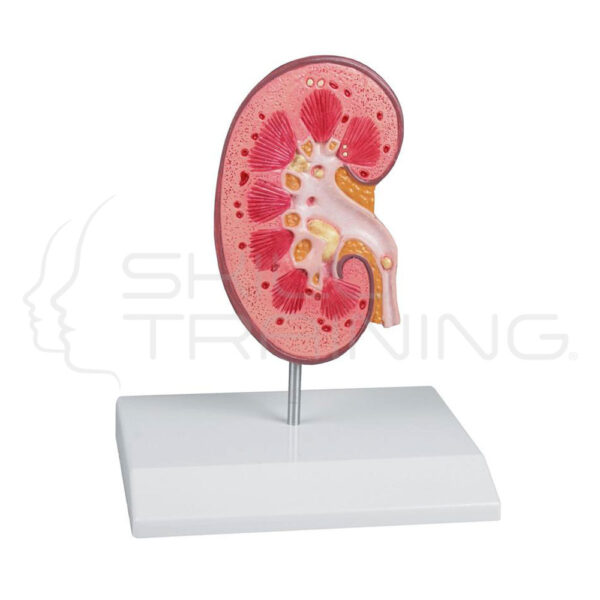 Modelo de riñón - normal y patología - Imagen 1