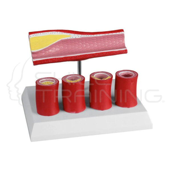 Arteria con 4 secciones arteriales - Imagen 1