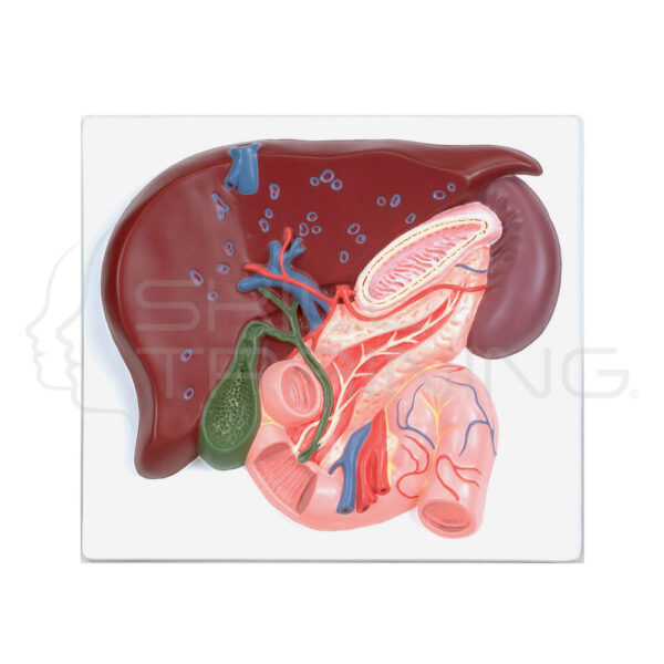 Hígado con vesícula biliar páncreas y duodeno - Imagen 1