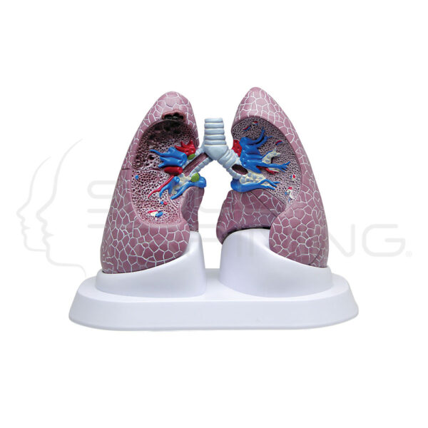 Lung Set with Pathologies - Imagen 1