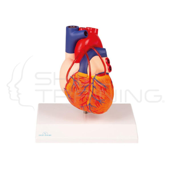 Heart with Bypass - Imagen 1