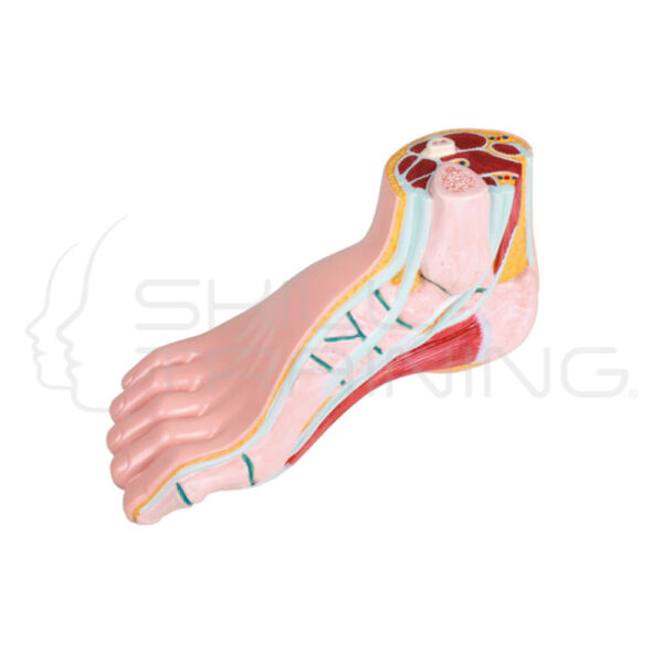 Hollow Foot, Pes Cavus - Imagen 1
