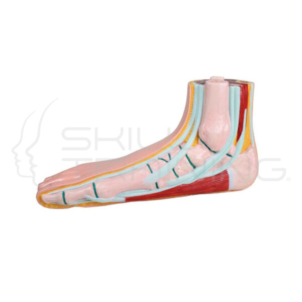 FlaT Foot, Pes Planus - Imagen 1