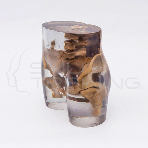 X-Ray Phantom Pelvis, Transparent - Imagen 1