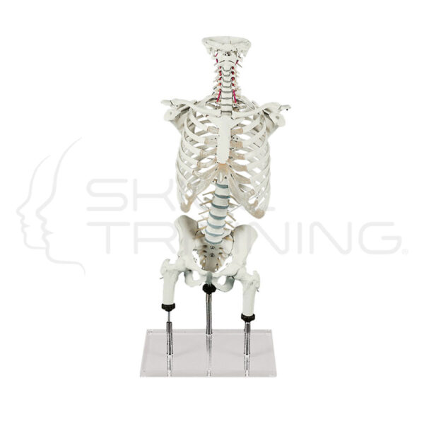 Vertebral Column for Demo of Malpositions - Imagen 1