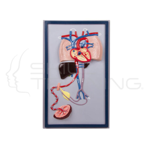 Fetal Circulation - Imagen 1