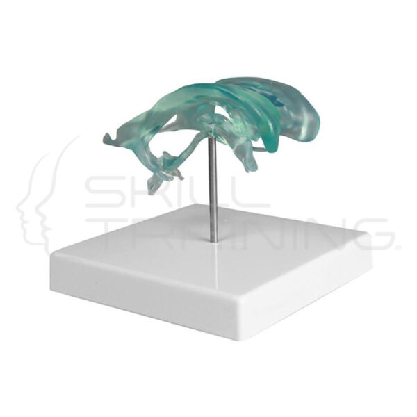 Brain Ventricle - Imagen 1