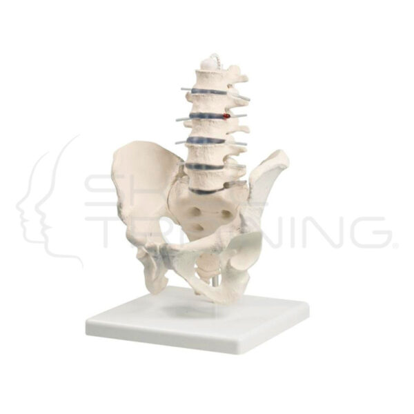 Lumbar Spine with Pelvis - Imagen 1