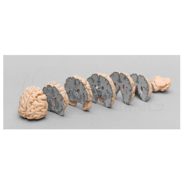 Cerebro Humano Multiples Secciones Frontales - Imagen 1