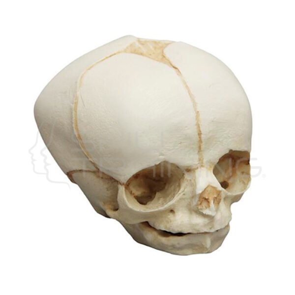 Craneo Fetal de 30 Semanas - Imagen 1
