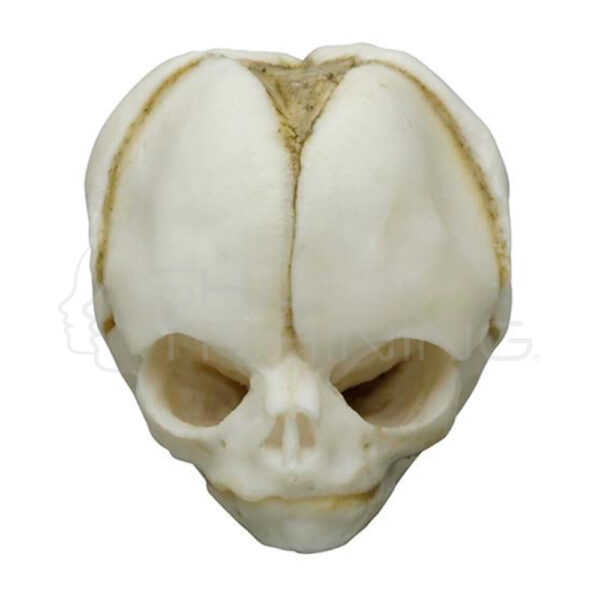 Craneo Fetal de 20 Semanas - Imagen 1