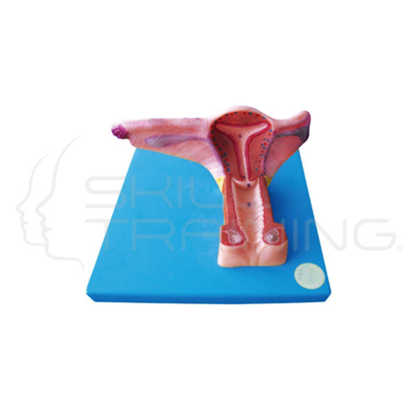 Female Inner Genital Organs - Imagen 1