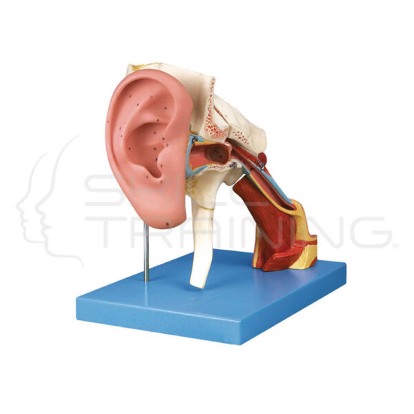 Enlarged Ear - Imagen 1