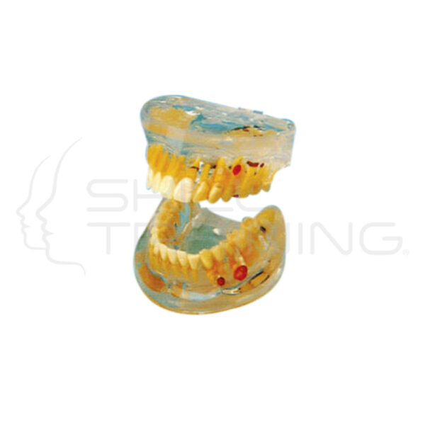 Transparent Dental Pathology Model 16 Signs - Imagen 1