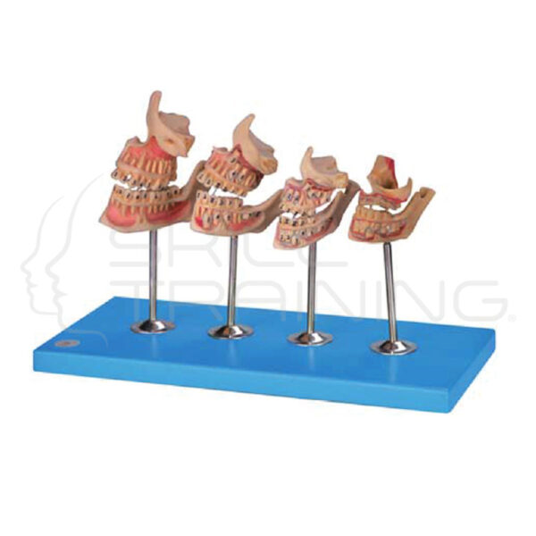 Development of a Set of Teeth - Imagen 1