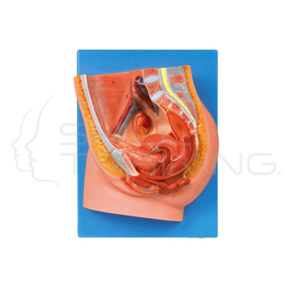 Median Section of Female Pelvis - Imagen 1
