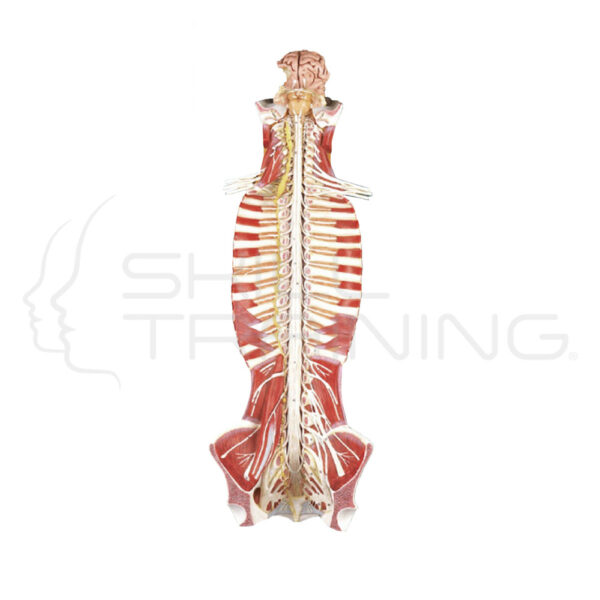 Spinal Cord in the Spinal Canal - Imagen 1