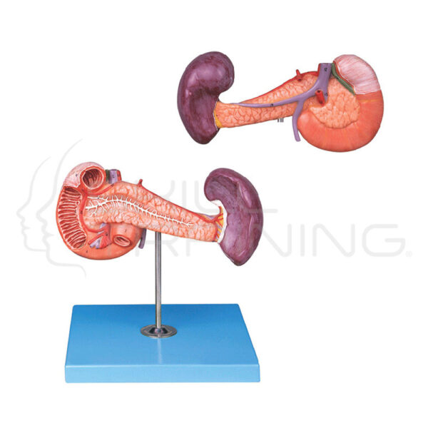 Pancreas with Spleen and Duodenum - Imagen 1