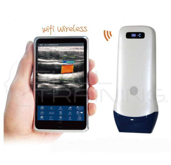 Ultrasonido Doppler Color Portátil - Transductor Lineal 5,0 - 10 Mhz - Imagen 1