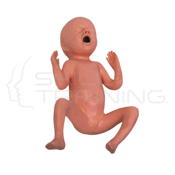 Bebe Prematuro de 24 Semanas - Imagen 1