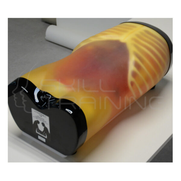 Us-5: Fast/acute Abdomen Phantom Fast/er Fan - Imagen 1
