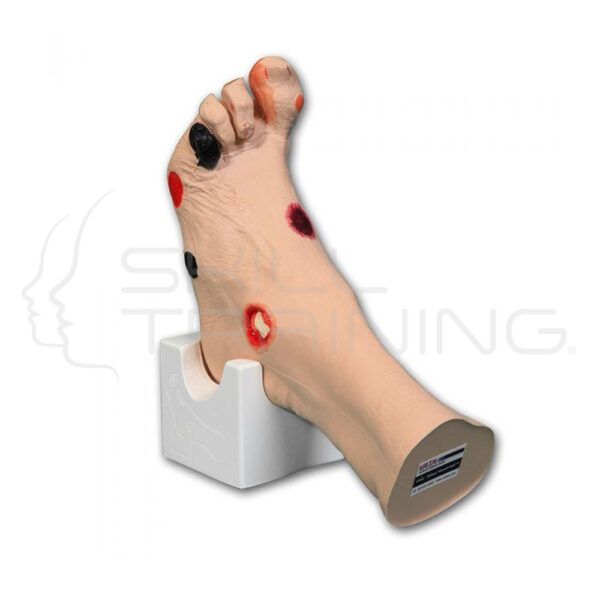 Wilma Wound Foot - Imagen 1
