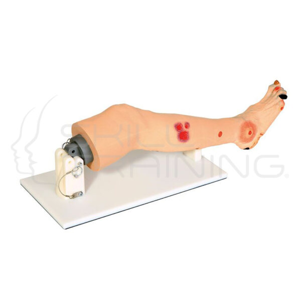 Annie Arterial Insufficiency Leg - Imagen 1