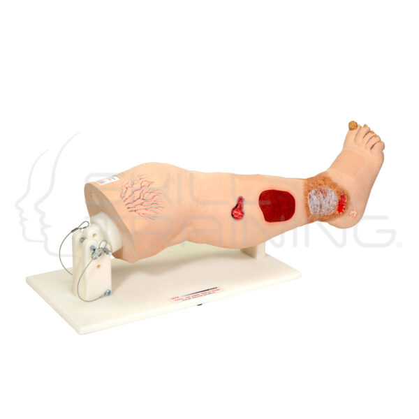 Vinnie Venous Insufficiency Leg - Imagen 1