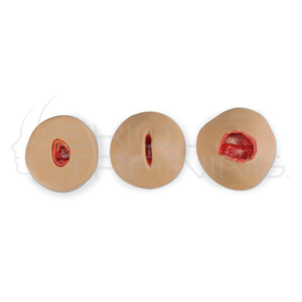 Negative-pressure Wound Therapy (npwt) - Imagen 1