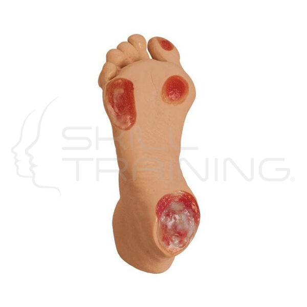Life/form Elderly Pressure Ulcer Foot-light - Imagen 1