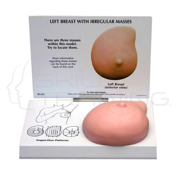 Left Breast with Cancer Model - Imagen 1
