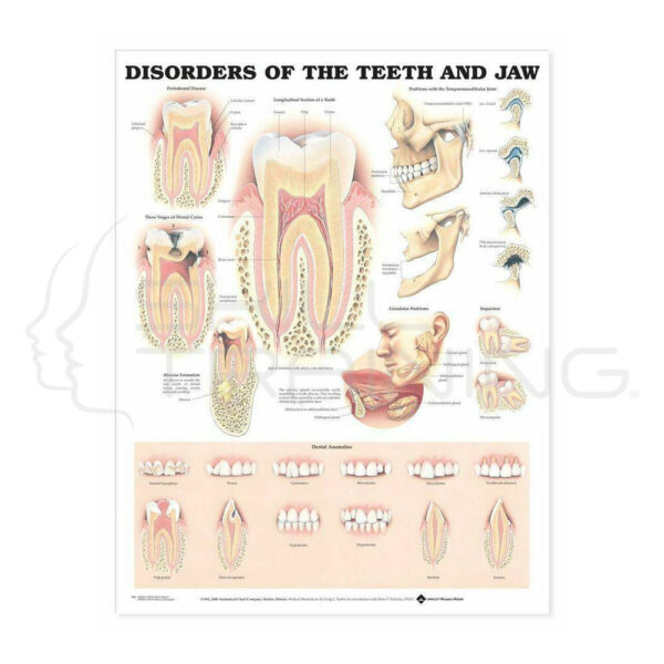 Disorder of the Teerh and Jaw Chart - Imagen 1