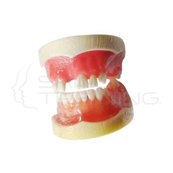 Modelo Implante Dental - Imagen 1